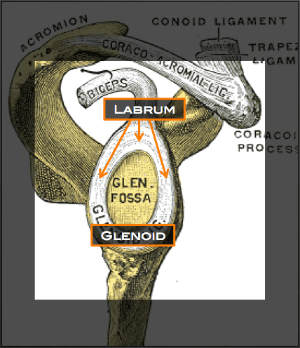 labral tear