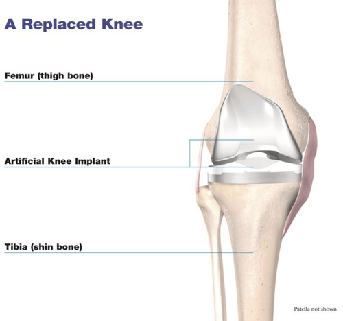 Hip Anatomy