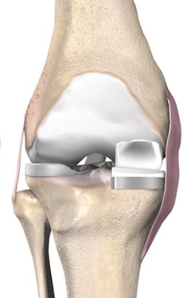 Hip Anatomy