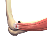 Tennis Elbow